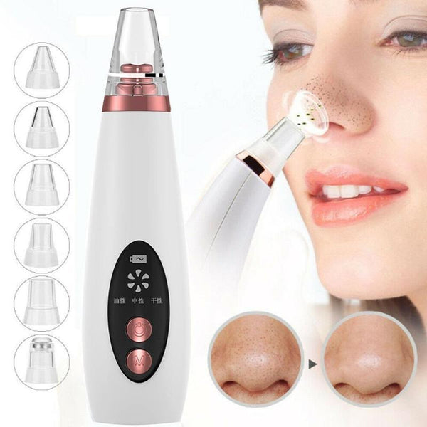 Gentle Pore Wizard